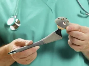 Csipőműtét vagy csipőprotézis műtét okai